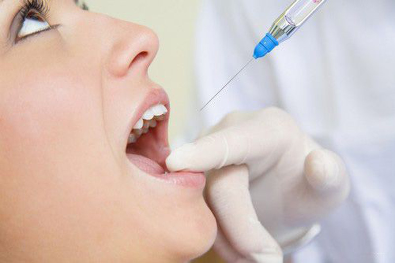 Nha sĩ của bạn sẽ lựa chọn mức độ gây mê sao cho hạn chế tối đa đau đớn của bạn khi nhổ răng. Chúng có thể là oxit nitơ, thuốc uống (như Halcion hoặc Valium) được sử dụng ngay trước đó. Hoặc thuốc an thần gây mê, thường được coi là thoải mái nhất vì bạn sẽ không thể nhớ những gì diễn ra sau đó.