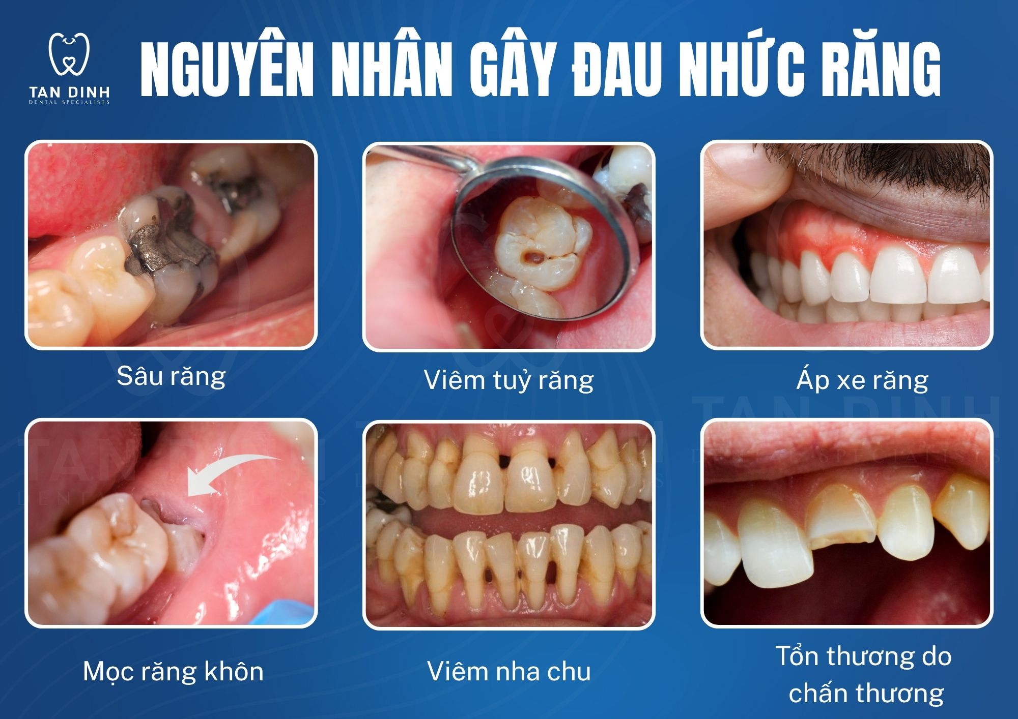 nha khoa Tân Định