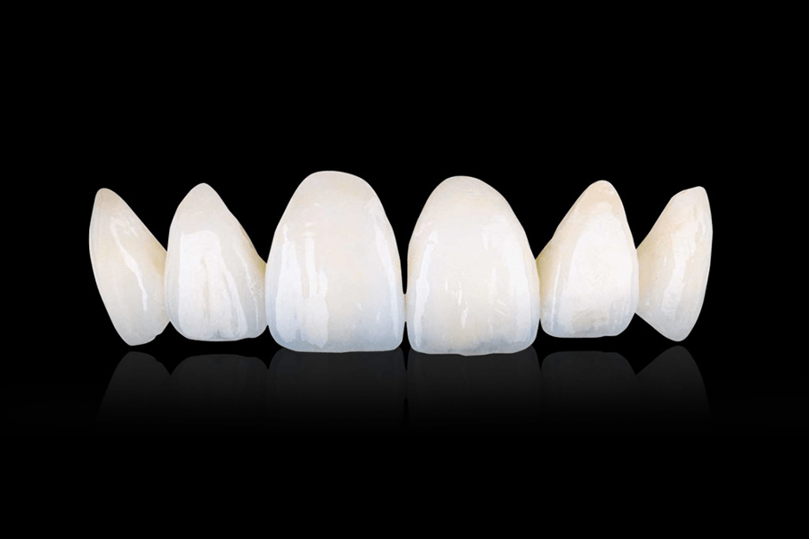Răng sứ Zirconia có mấy loại? Giá bao nhiêu? Khi nào thì nên lựa chọn?